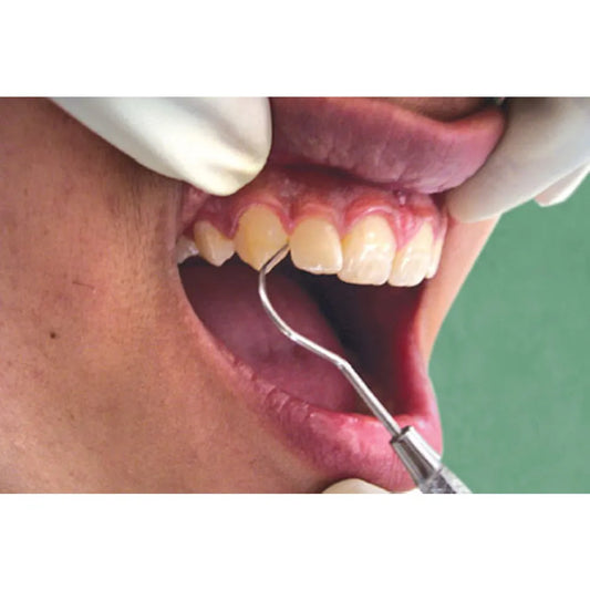 GDC Probe Explorer - Double Ended -4 (Exd5)