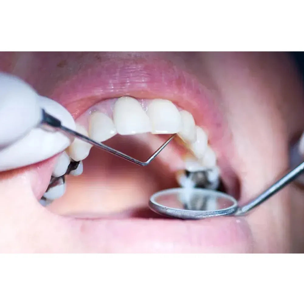 GDC Single End Probe -1 (Exs9)