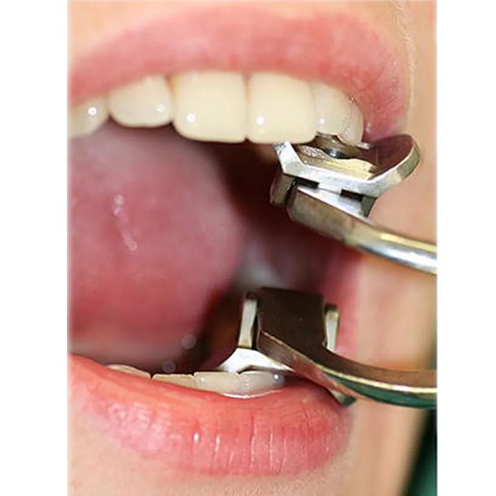 GDC Ferguson Mouth Gag