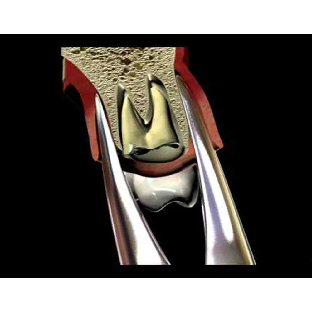 GDC Extraction Forceps Upper Roots - 30 Premium (Fx30P)