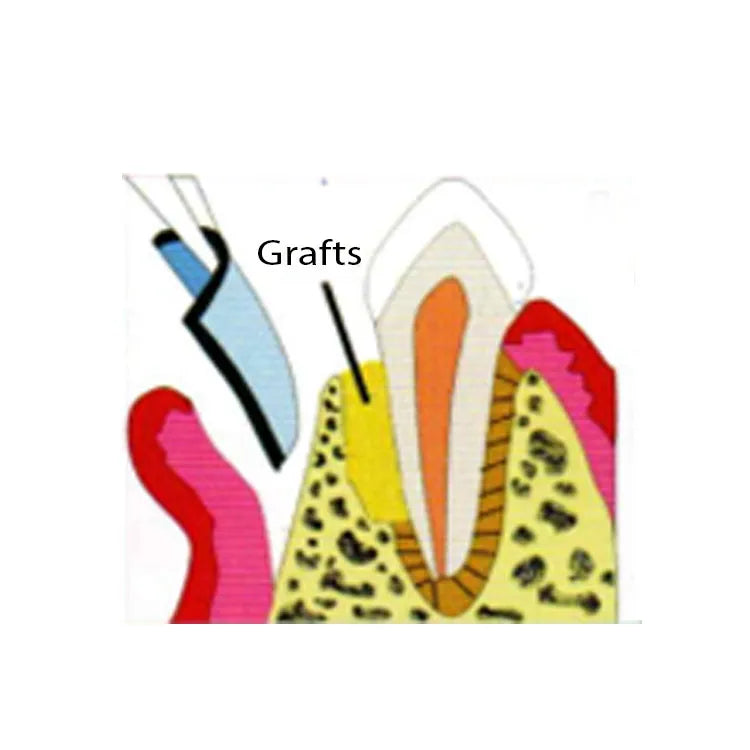 Cologenesis ColoGide GTR Membrane - Pack Of 1