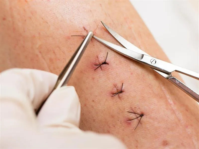 GDC Castroviejo Scissors