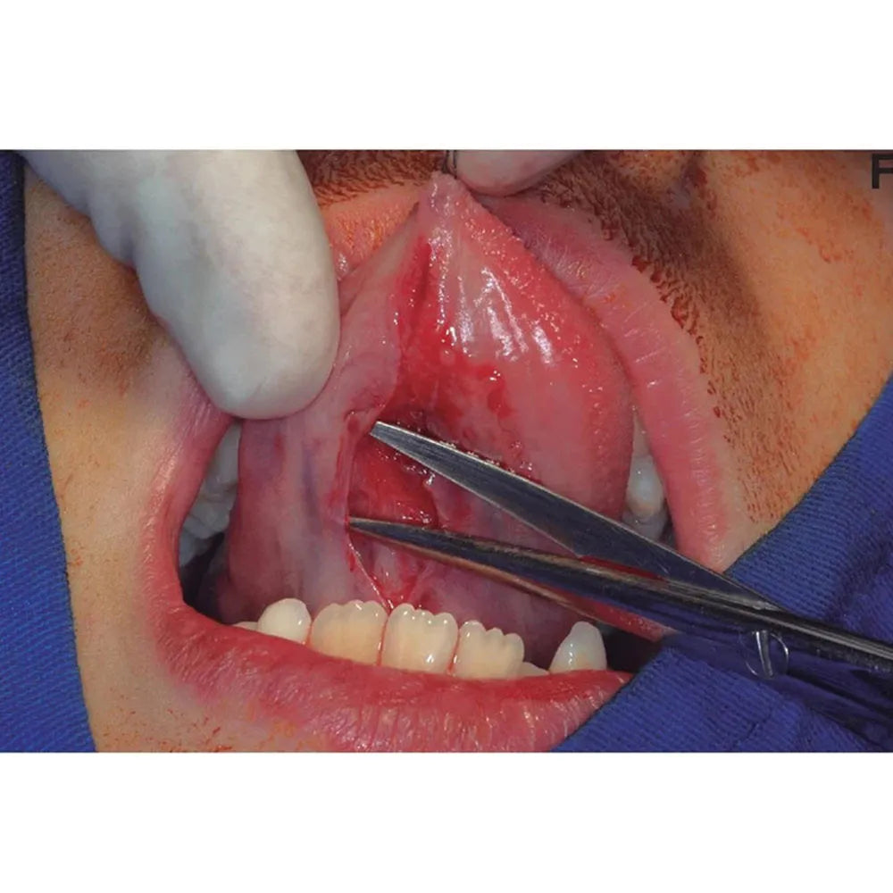 Oracraft Surgical Scissors