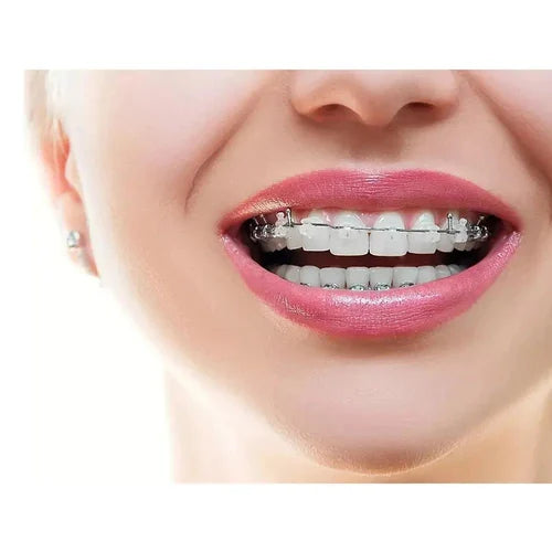 OSL Heat Activated NiTi Ovoid Form Archwires Round