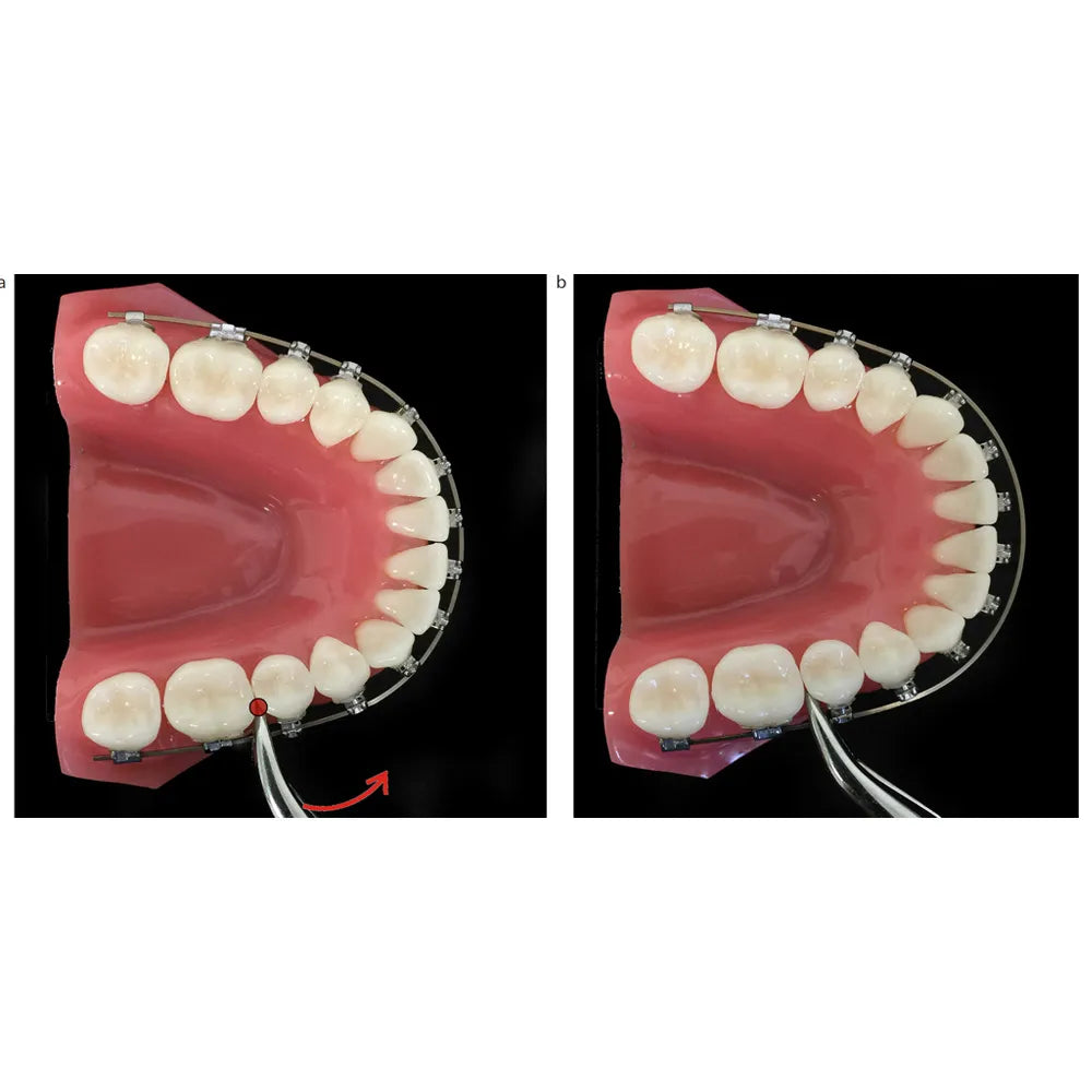 OrthoMetric SS Archwire - Rectangular (10/Pk)