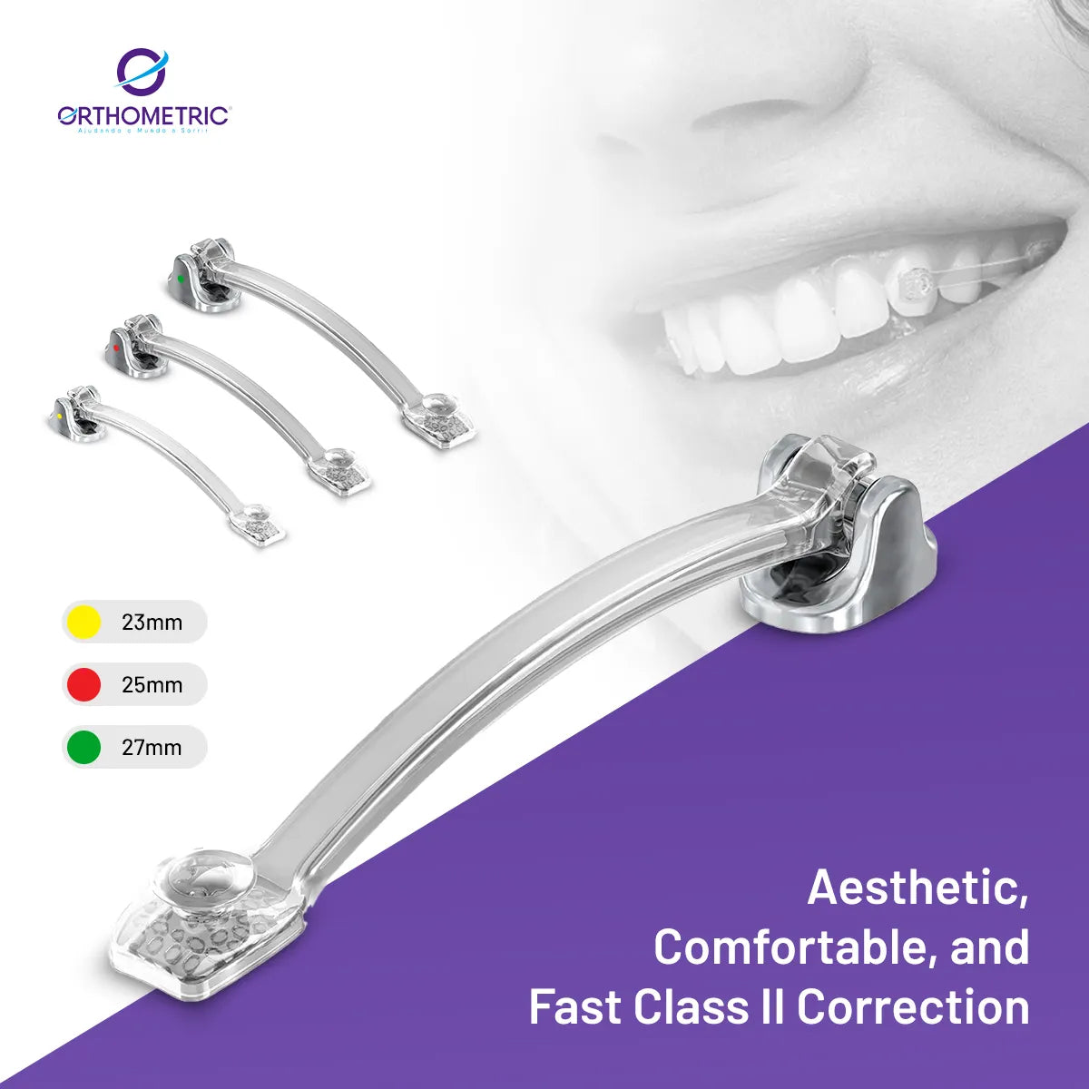 OrthoMetric Iceram Clear Distalizer (2/Pk)