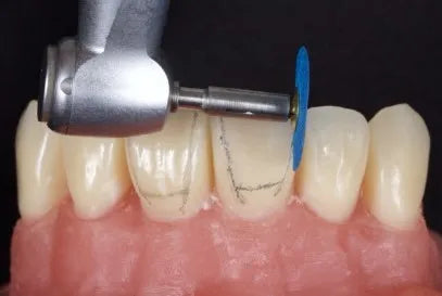Tor Vm Finishing & Polishing Kit