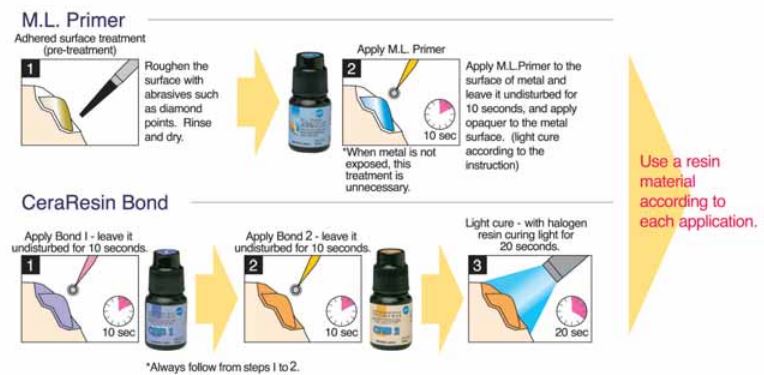 Shofu P & R Repair Kit