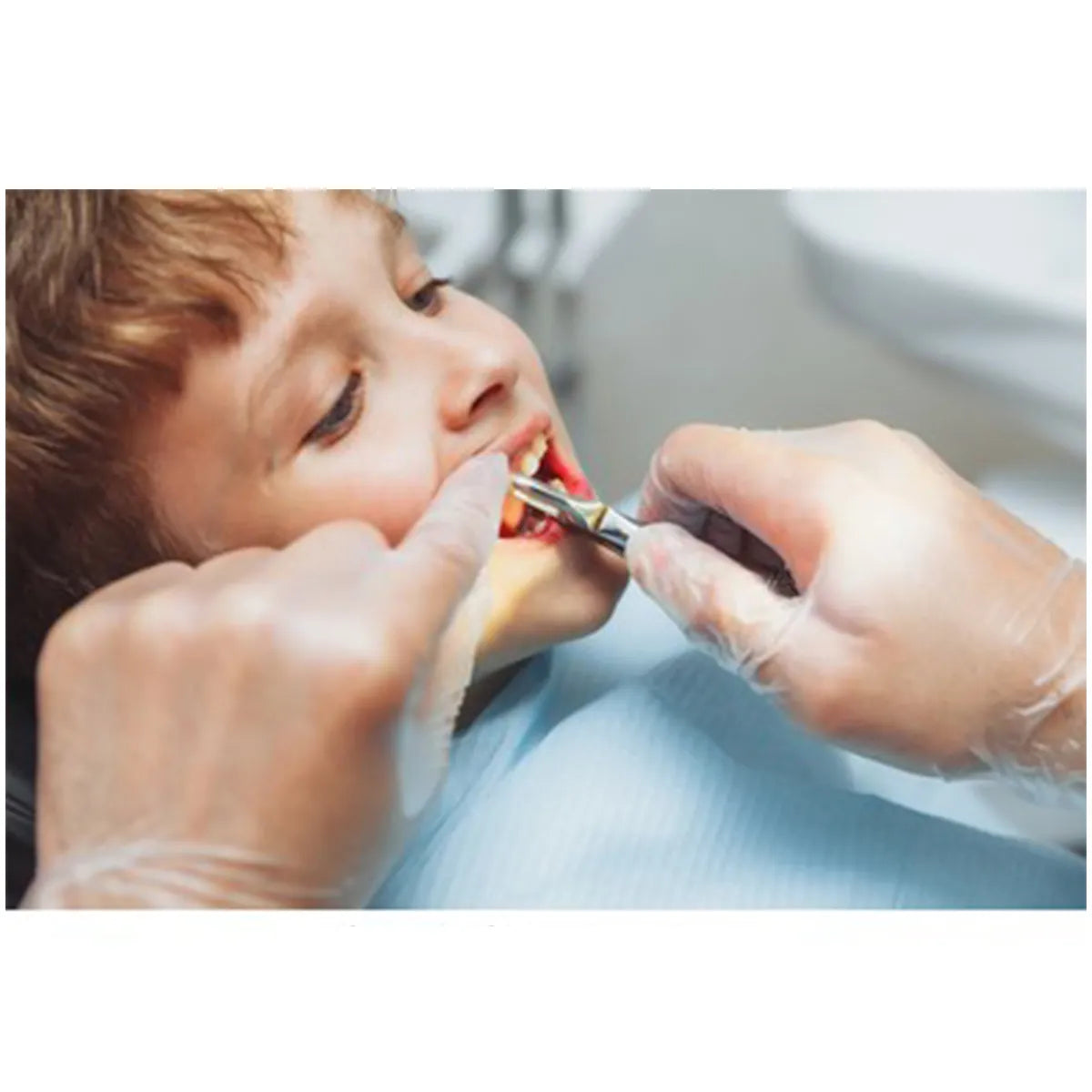 GDC Extraction Forceps Pedo