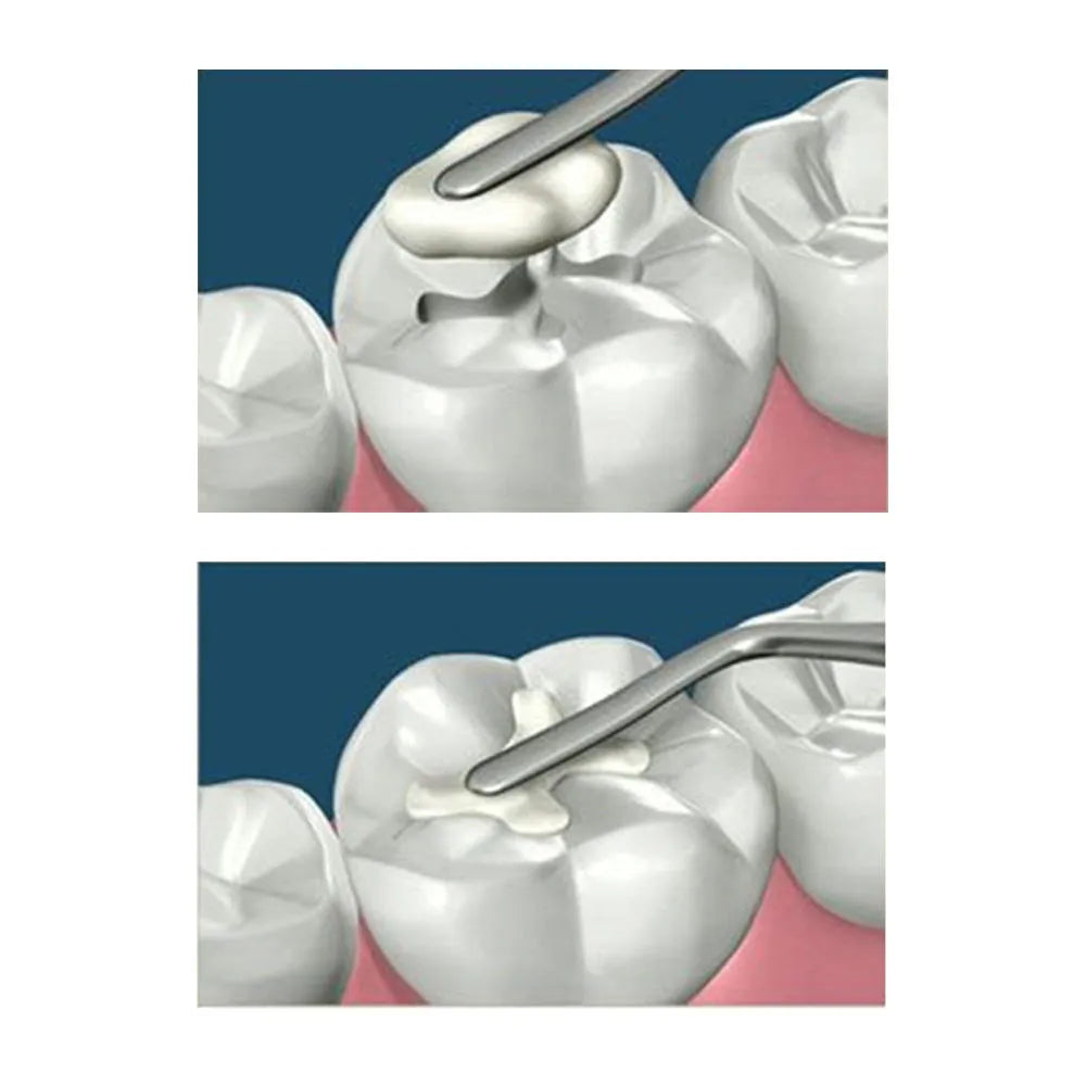 Oracraft Plastic Filling Instruments