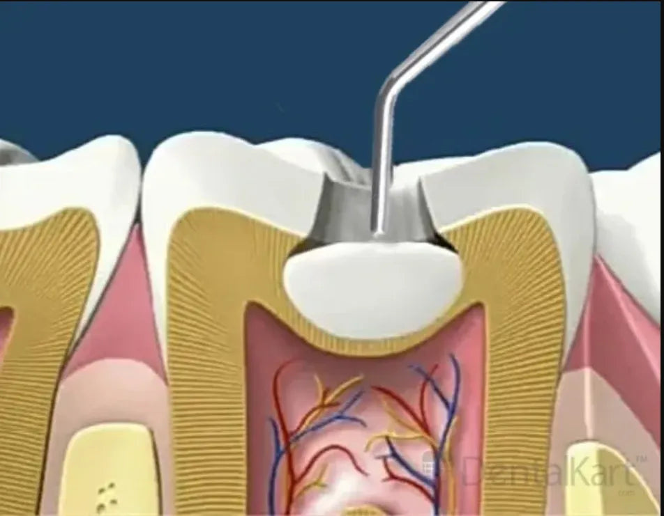 Meta Nexcomp Flow Composite