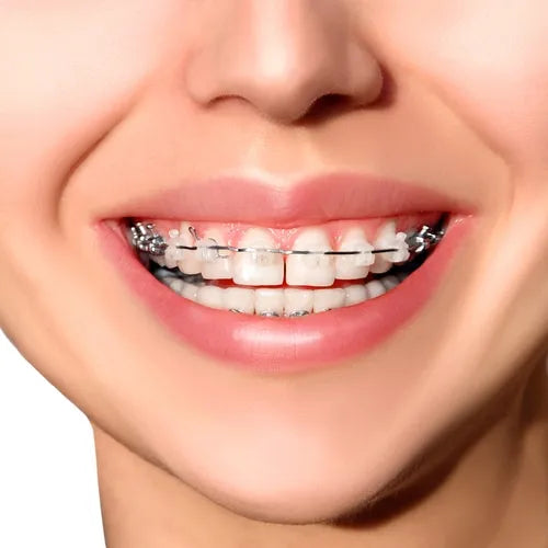 Prime Ortho NiTi Archwires Natural / Pro Form - Rectangular (25/Pk)