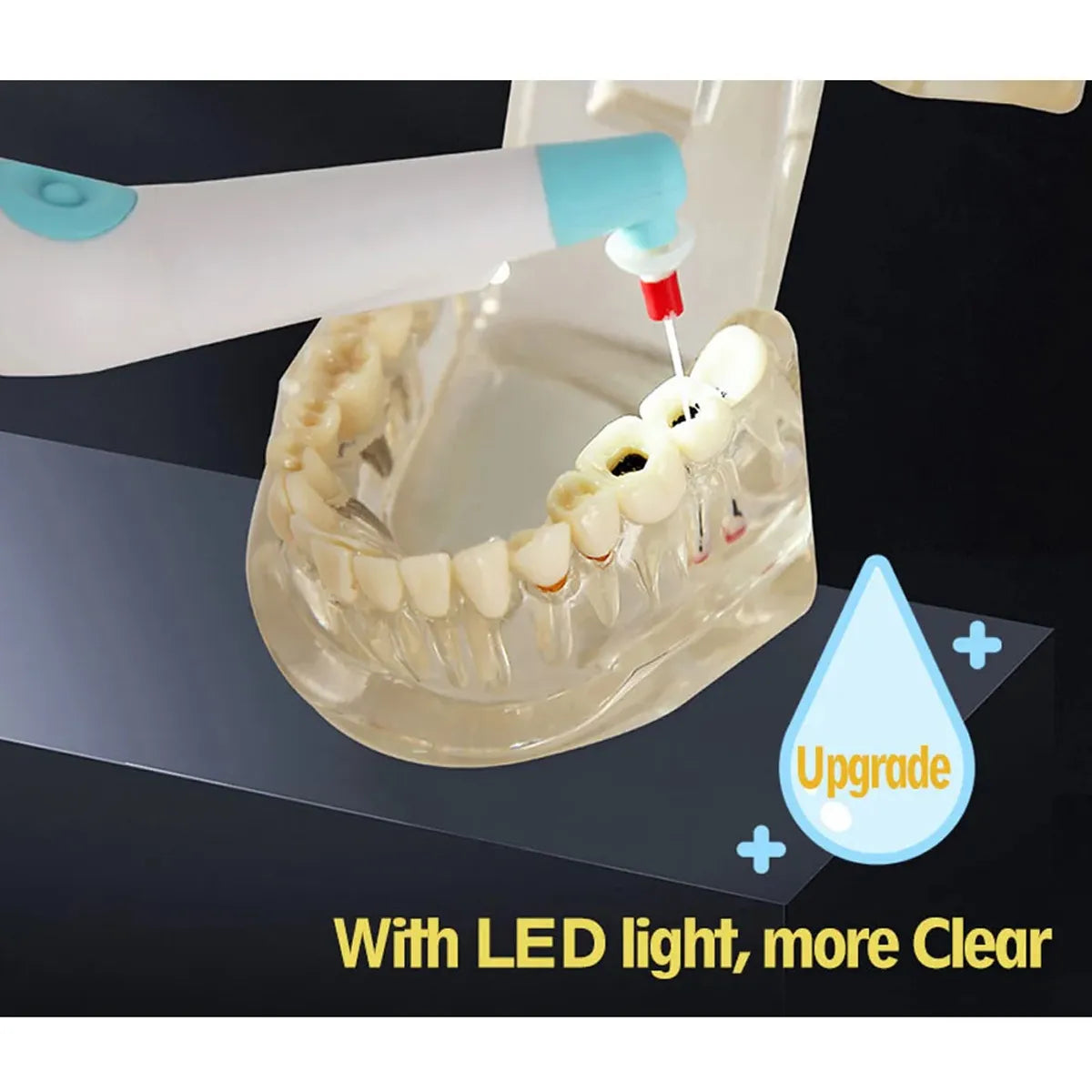 SuperEndo Sonic Flush Endo Irrigator LED (120 Tips Free)