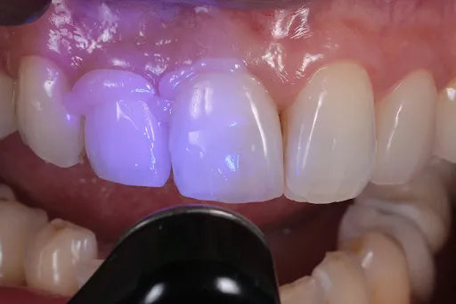 GC G-CEM One Paste Pak - Starter Kit (Translucent)