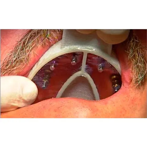 Cotisen Implant Impression Tray Refills