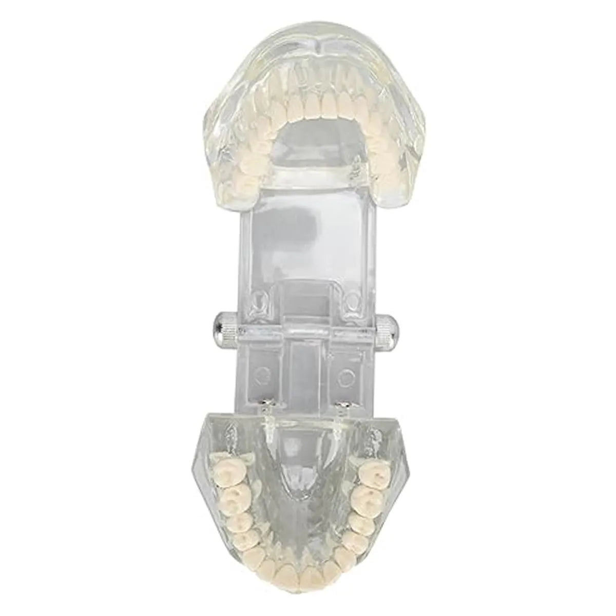 JJ Ortho Class II Division II Orthodontic Model (10.10.03)