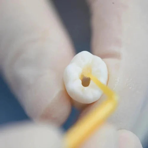 Vincismile HugeBond Universal Light Cure Bonding Agent