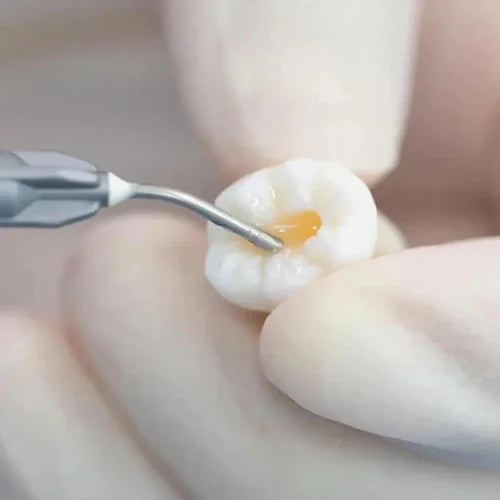 Vincismile Trusfil Flow Flowable Composite