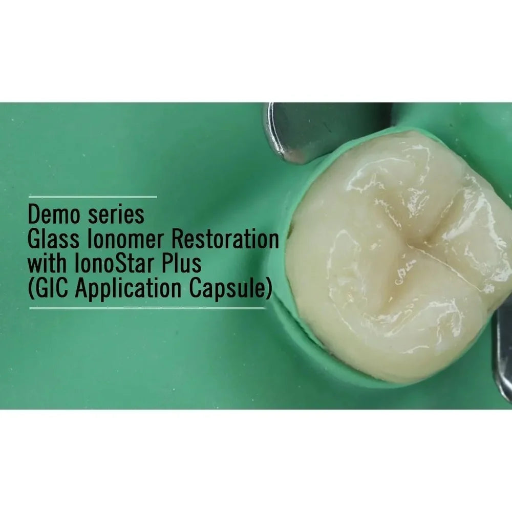 Voco IonoStar Plus Fast Set Glass Ionomer Capsule