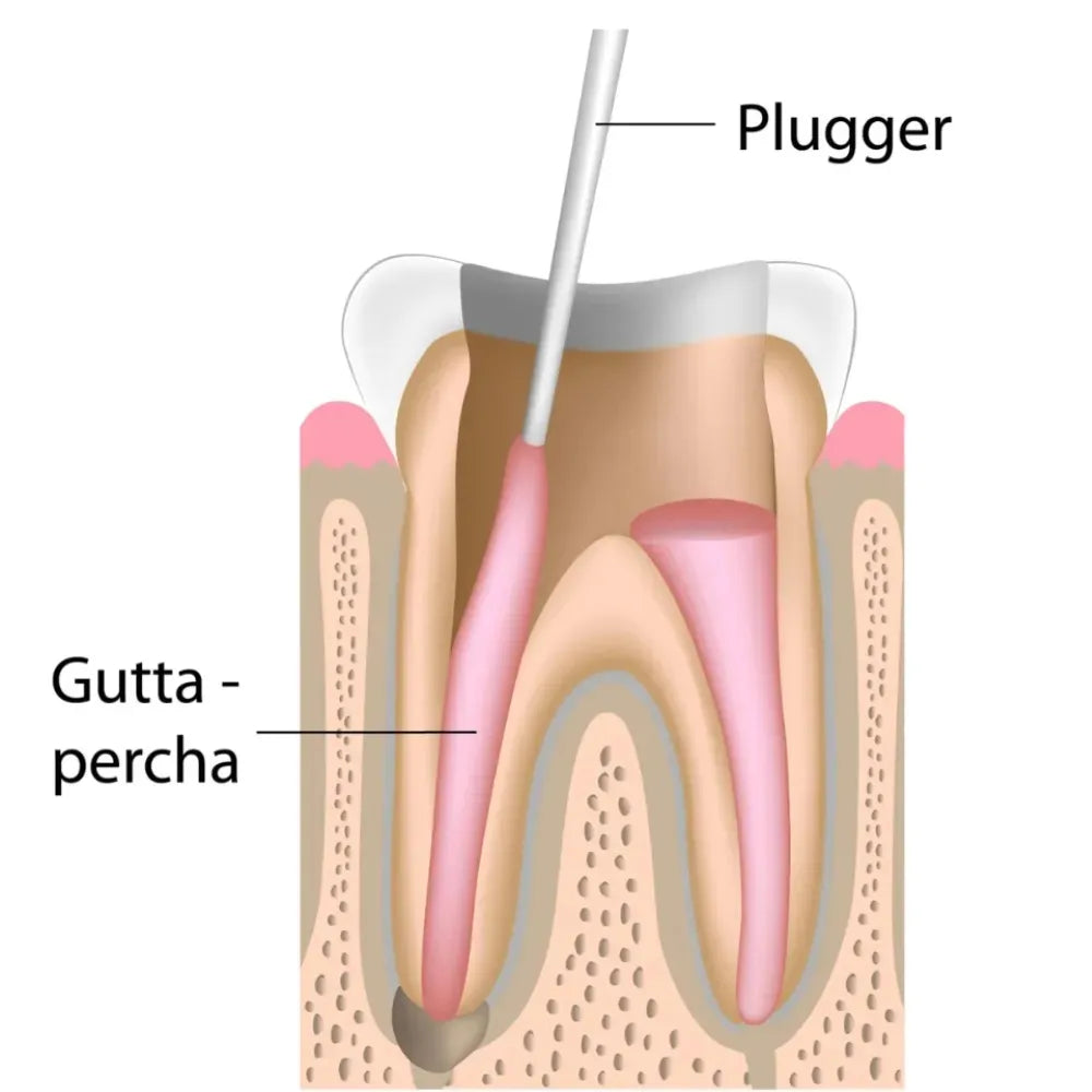 GDC Root Canal Plugger Luks -(.50mm) Rcpl2 #3