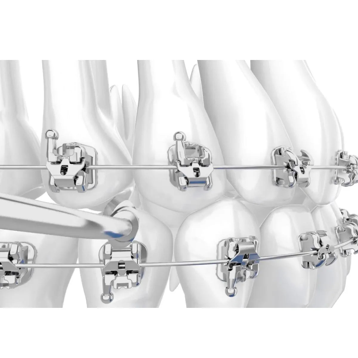 JJ Ortho Selfy Passive Metal Self Ligating Bracket Kit (10.05.10)