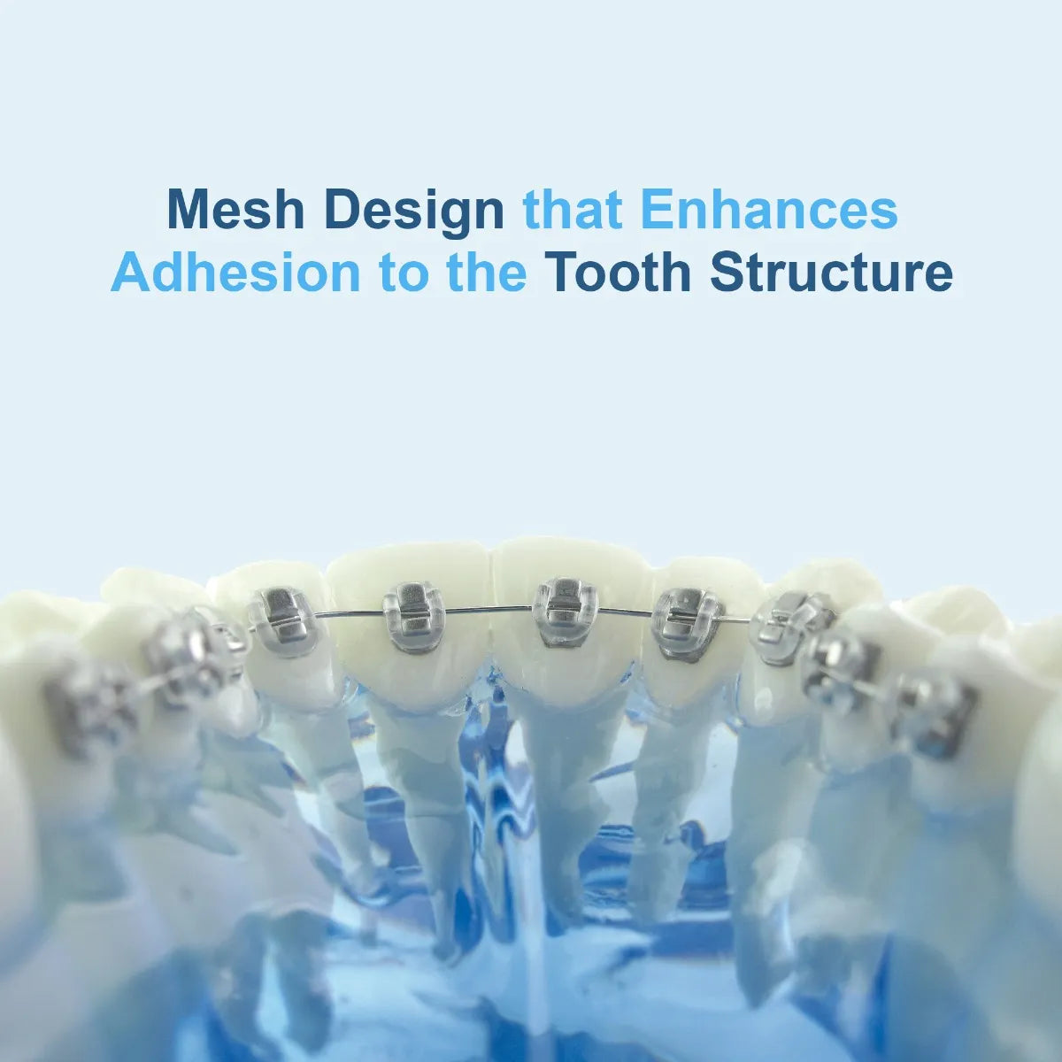 U Ortho Lingual Brackets 018
