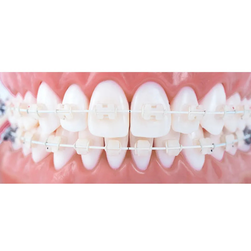 U ortho Niti Tooth Color Wire-Rectangular