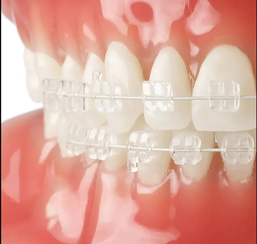 U Ortho Niti Tooth Color Wire - Ovoid