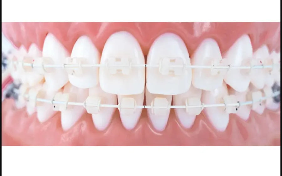 U Ortho Niti Tooth Color Wire - Ovoid