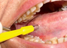Disposable Biopsy Punch Standard