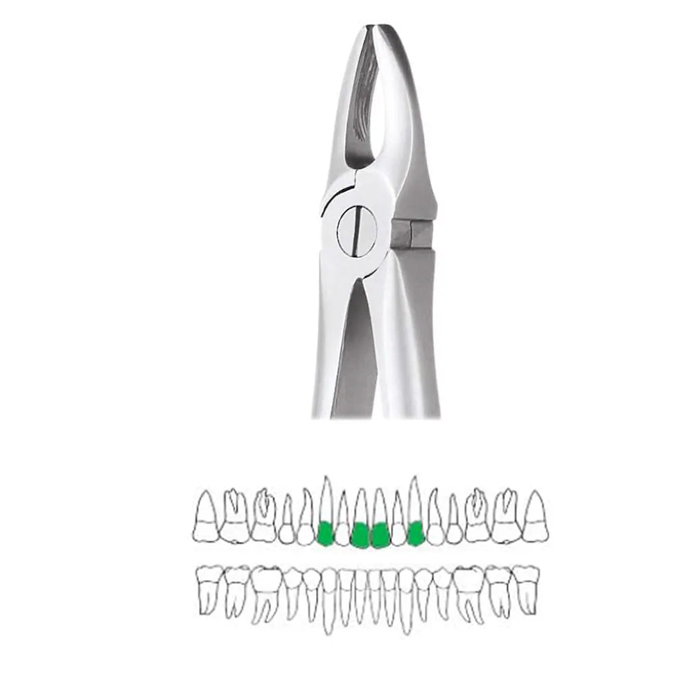 GDC Extraction Forceps Upper Anteriors - 1 Ergonomic (Fx1e)