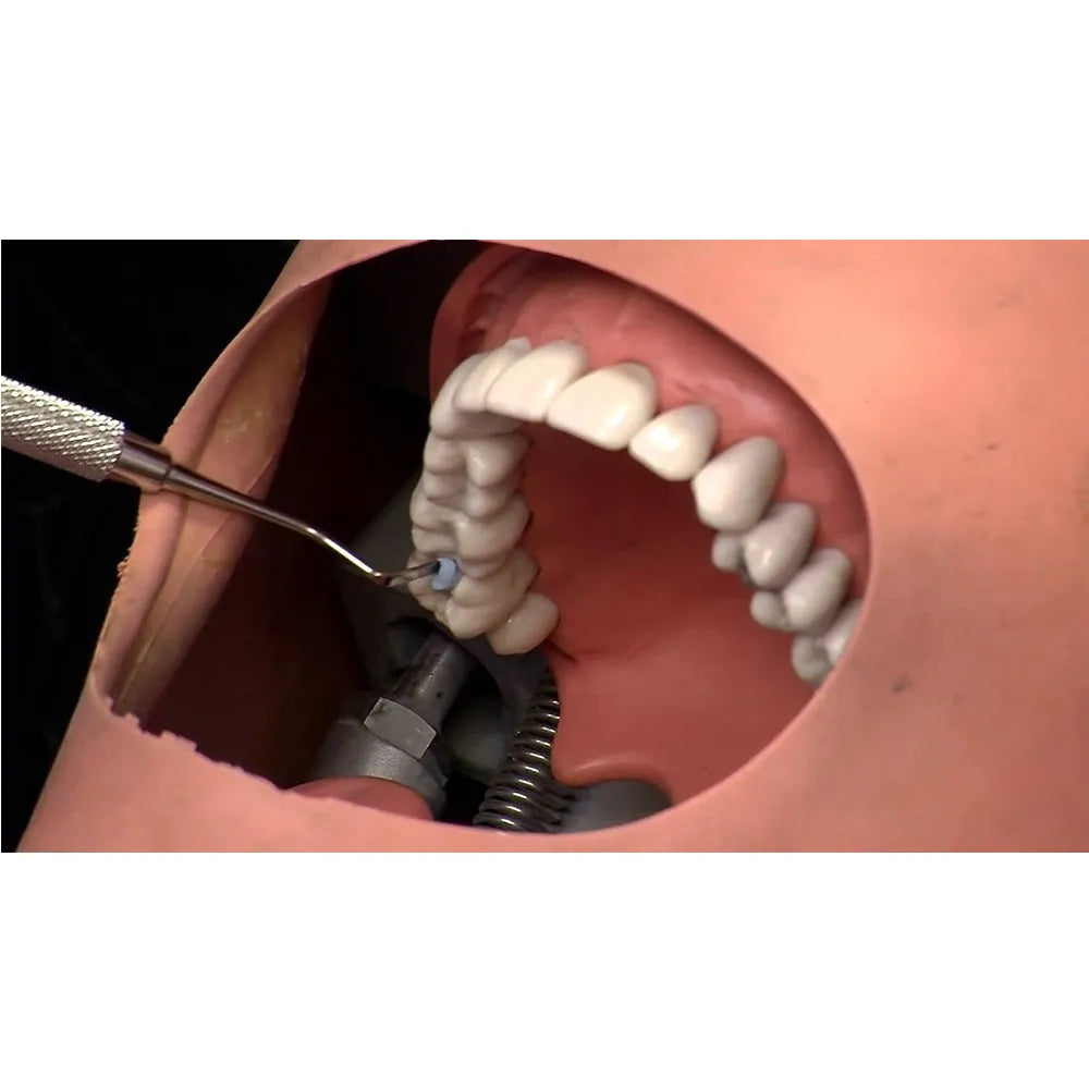 GDC Plastic Filling Instrument - 4 (PF21)