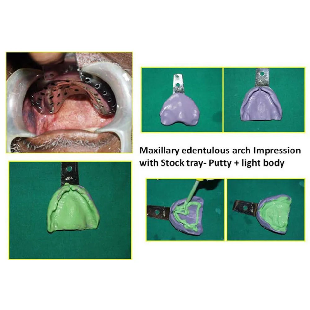 GDC Edentulous Perforated Impression Trays Upper #2 (ITRLEDPU2)