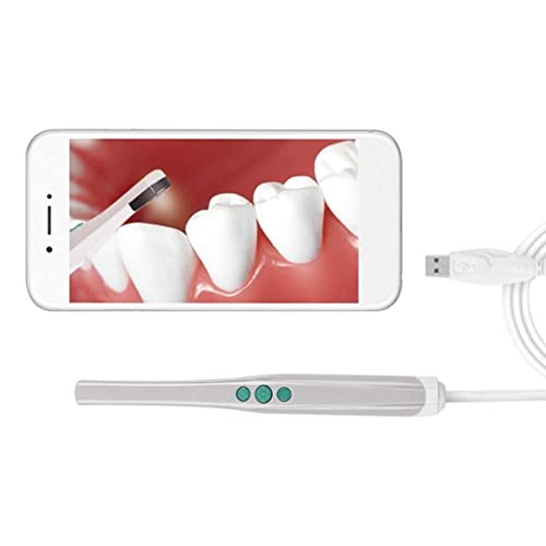 Qualdent Dental USB Intraoral Camera (5MP, Auto Focus)