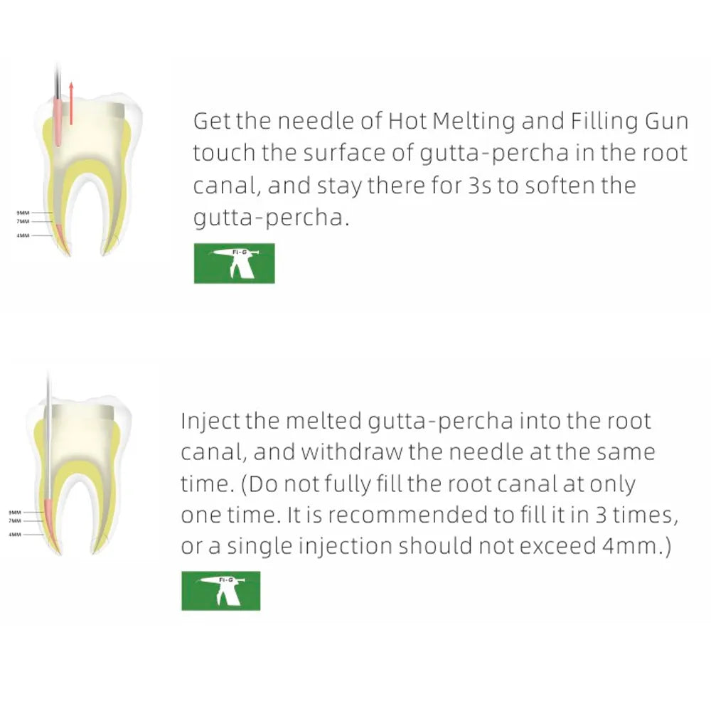 Woodpecker Fi-G Obturation Gun Tips