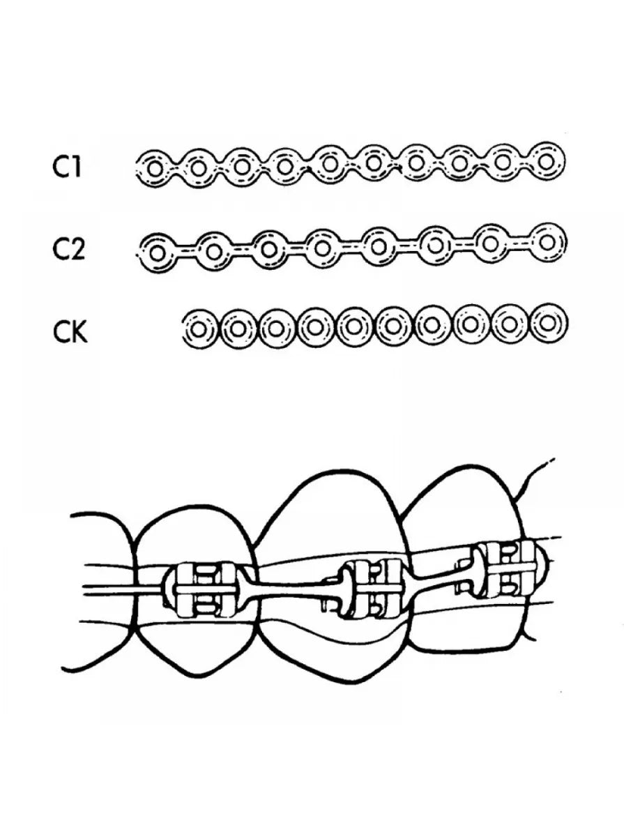 3M Unitek Alastik Bobbin Chain