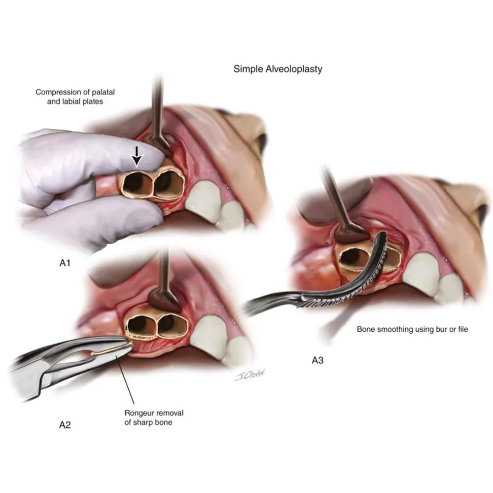 GDC Oral Surgery Impaction Kit (OSIP22)