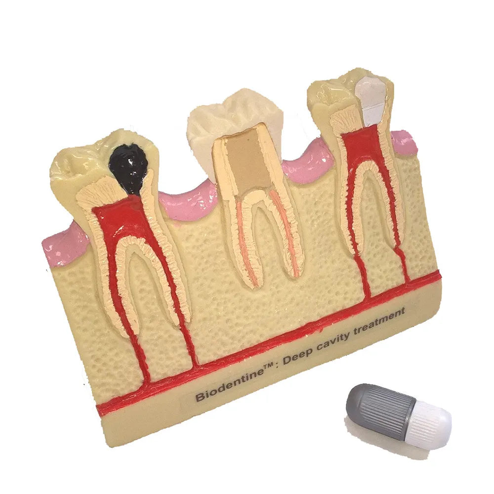 Septodont Biodentine(Single Pouch)