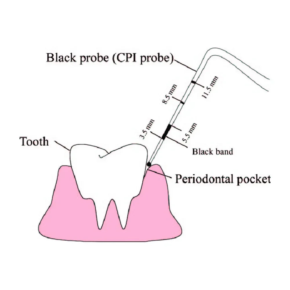 GDC Double End Probes Unc 15 / Screening Probe #6 (PCP15/11.5)