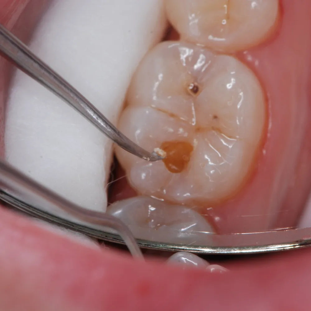 GDC Spoon Excavator -6 (Exc127/128)