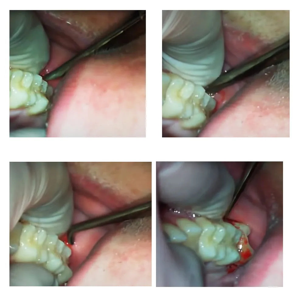 GDC Root Elevators Warwick James Set Of 3 (Ewjs3)