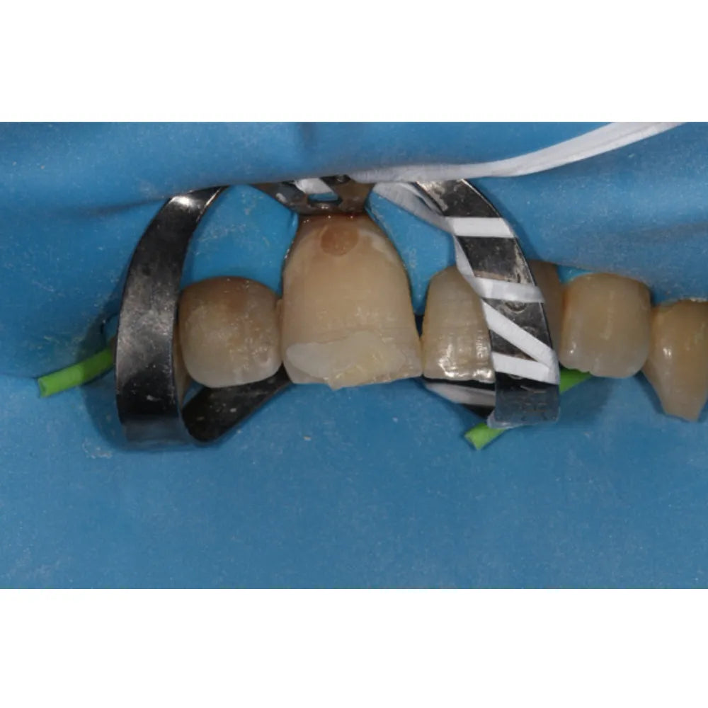 GDC Rubber Dam Frame Plastic (Rdaf6p)