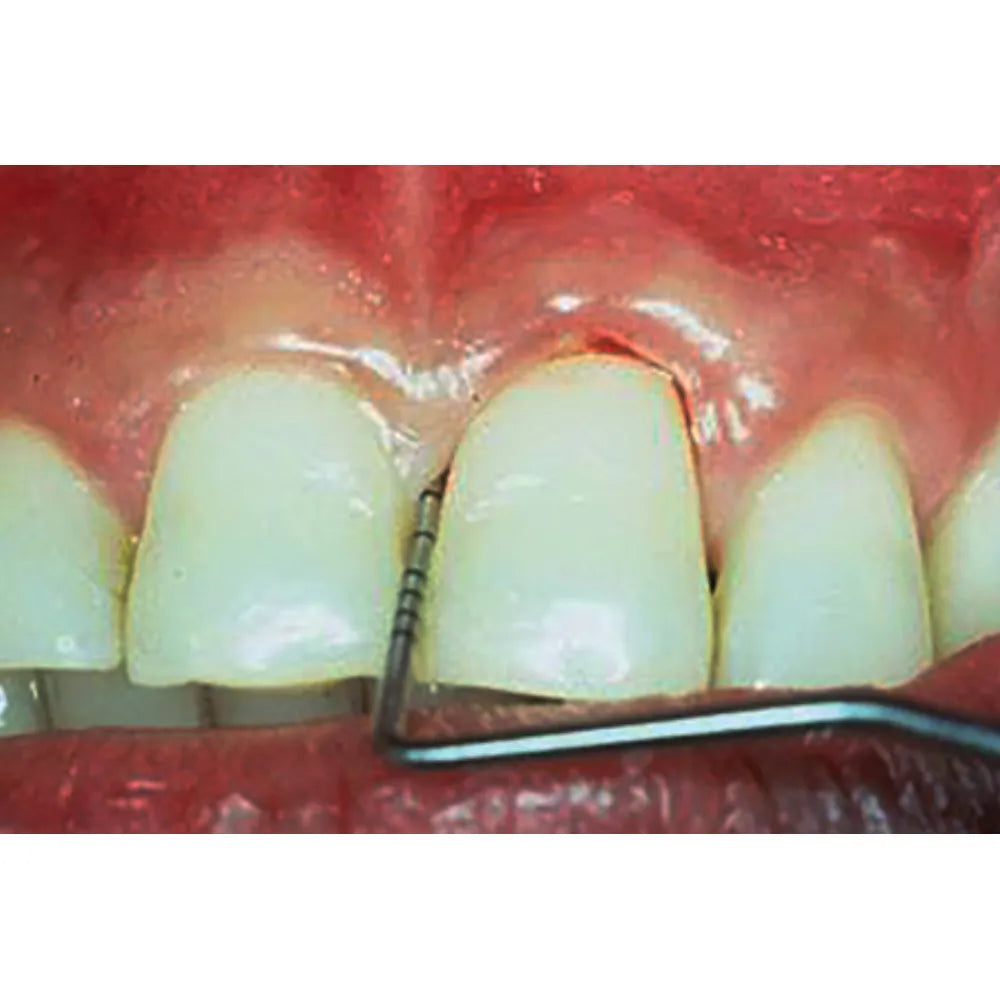 GDC Single End Probes Thin William #6 (Pow6)