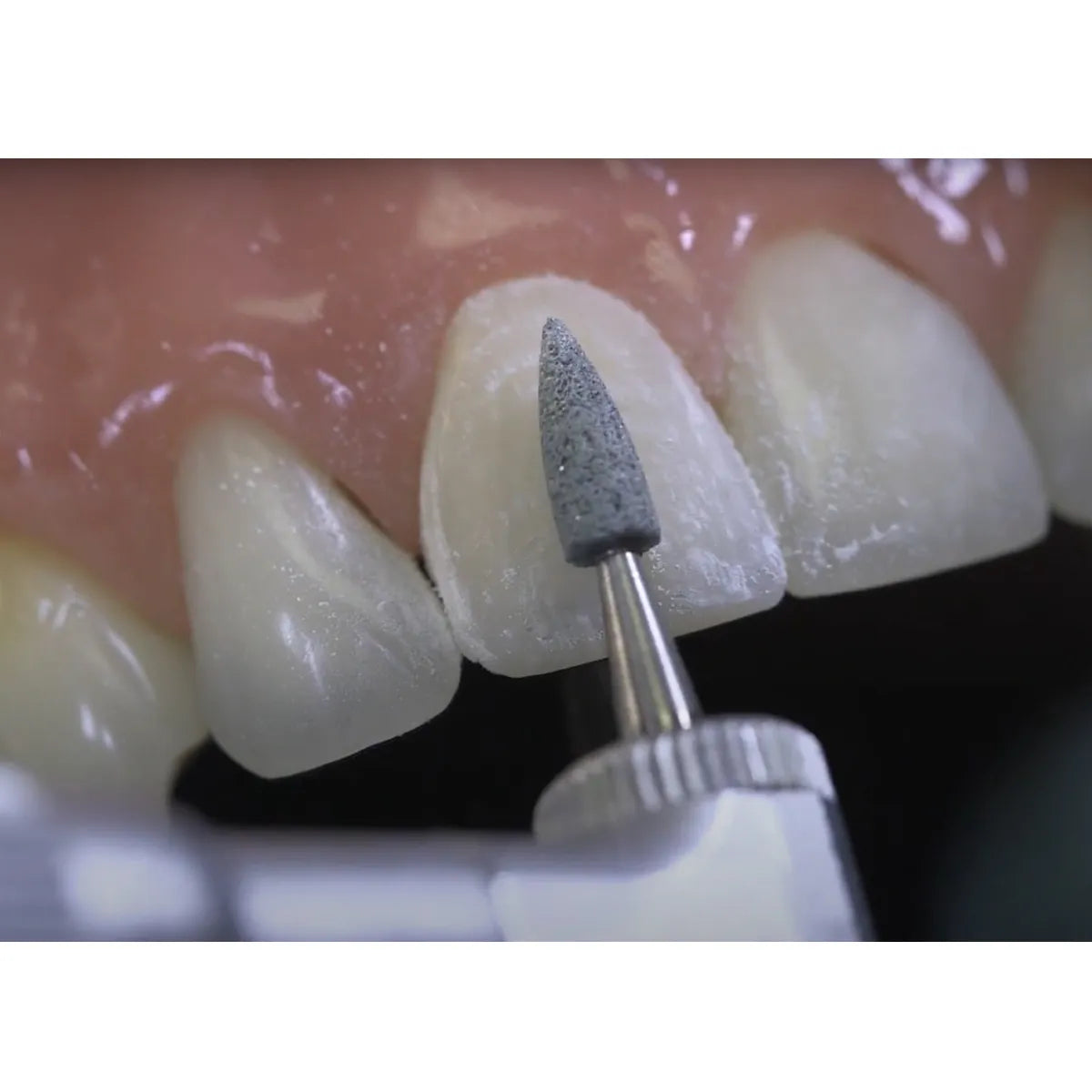 LD Composite Finishing Kit - LD-272