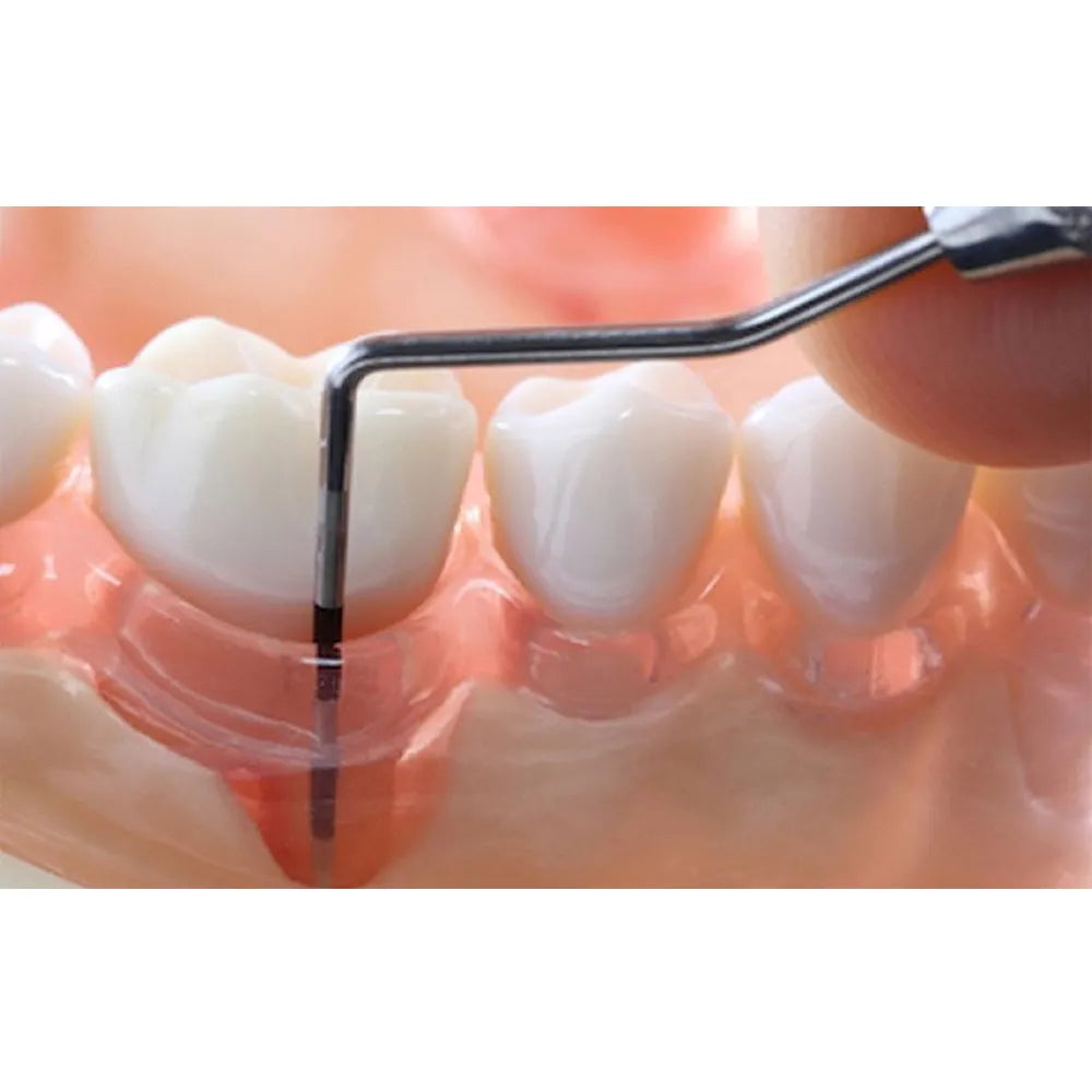GDC Double End Probes Unc 15 / Screening Probe #6 (PCP15/11.5)