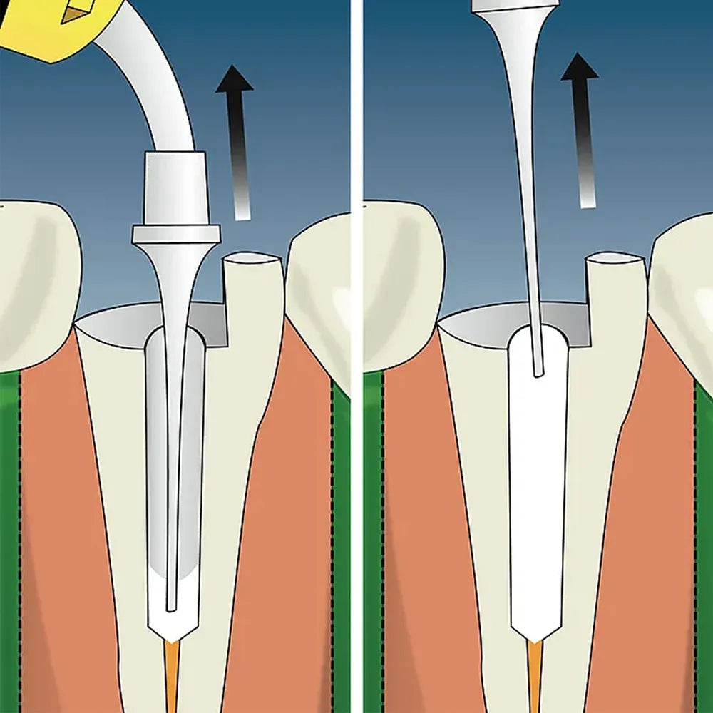 Prime Dental Rc Cal-I