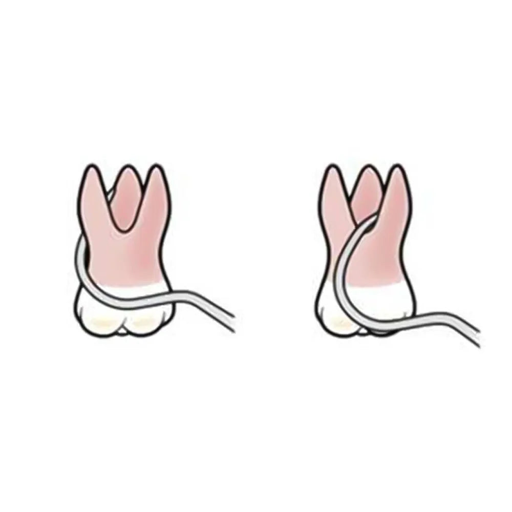 GDC Double End Probes Nabers Color Coded # 6 (Pq2n)