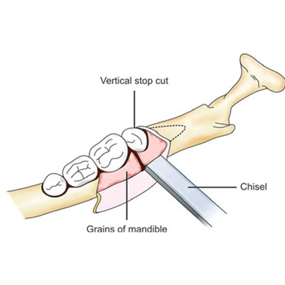 GDC Bone Chisel Chandler (5mm) (CC7)