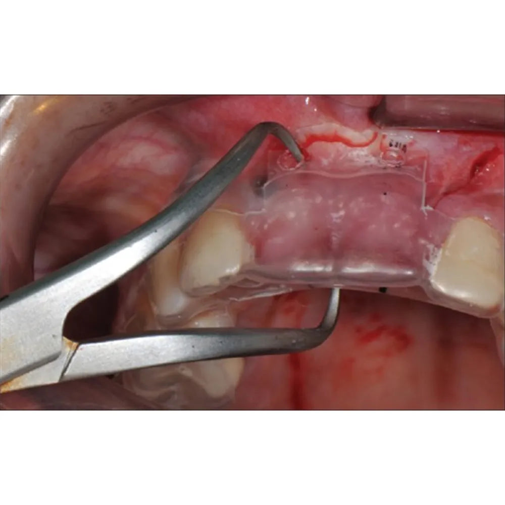 GDC Implantology Bone Caliper with Scale Bc35
