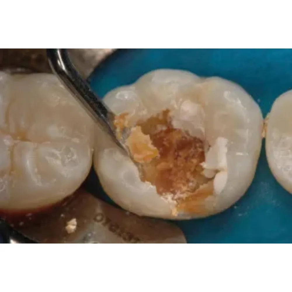 GDC Spoon Excavator Oval Shape #6 EXC18WH